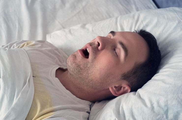 Obstructive Sleep Apnea